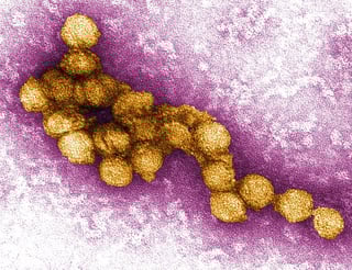 Picture of West Nile virus