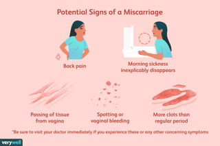 Picture of miscarriage