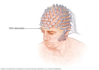 Picture of Electroencephalography