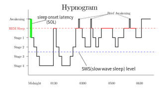Picture of Rapid eye movement sleep