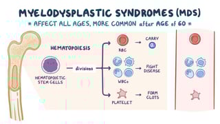 Picture of myelodysplastic syndrome