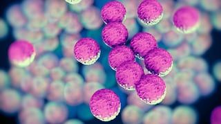 Picture of MRSA Super bug