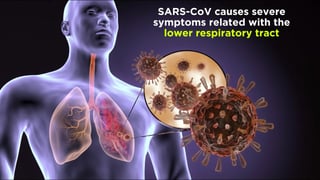 Picture of severe acute respiratory syndrome