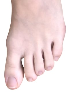 Picture of toe