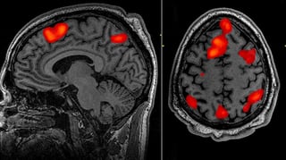 Picture of Functional magnetic resonance imaging