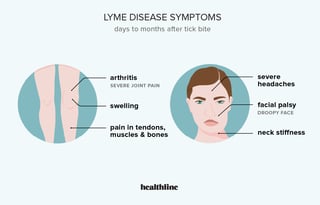 Picture of Lyme disease