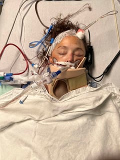 Picture of coma