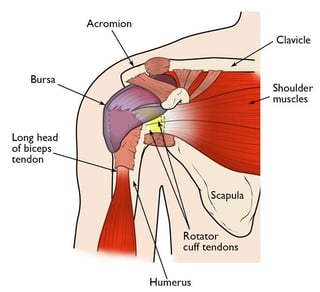 Picture of Shoulder problem