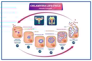 Picture of chlamydia infection