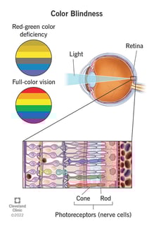 Picture of color blindness