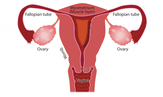 Picture of Menstruation