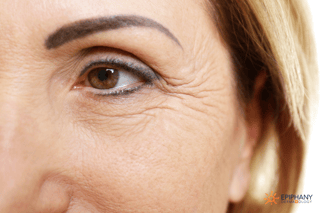 Picture of wrinkle
