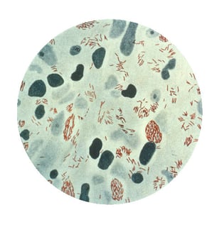 Picture of Mycobacterium leprae