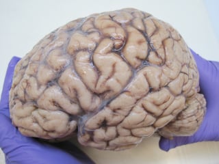 Picture of human brain