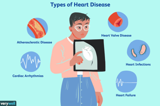Picture of heart disease