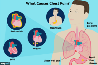 Picture of chest pain