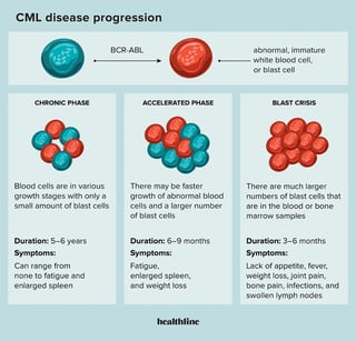 Picture of chronic myeloid leukemia