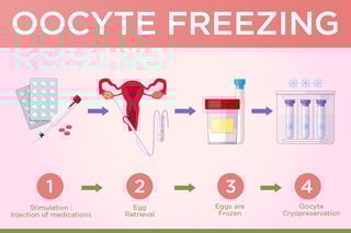 Picture of Oocyte cryopreservation
