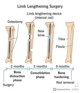 Picture of limb