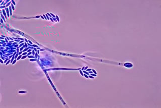 Picture of Fusarium