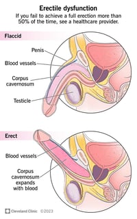 Picture of erectile dysfunction