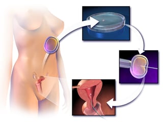Picture of Assisted reproductive technology