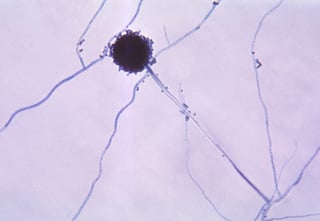 Picture of Aspergillus