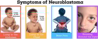 Picture of neuroblastoma