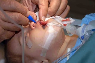 Picture of Reconstructive surgery