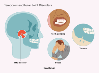 Picture of temporomandibular joint syndrome