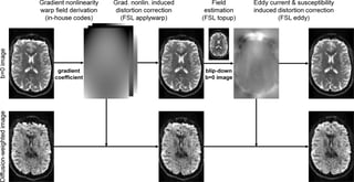 Picture of Diffusion MRI