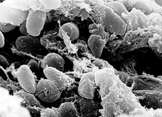 Picture of Yersinia pestis