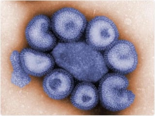 Picture of Influenza A virus subtype H1N2