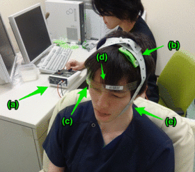 Picture of Transcranial direct-current stimulation