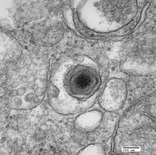 Picture of African swine fever virus