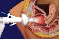Picture of Gynaecology