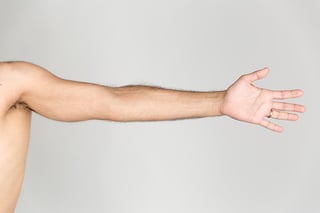 Picture of Arm
