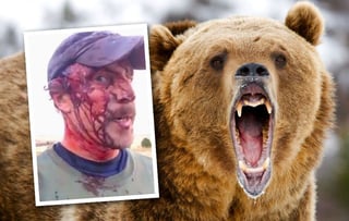 Picture of Bear attack
