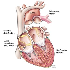 Picture of cardiac arrest