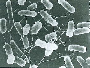 Picture of Enterohemorrhagic E. coli