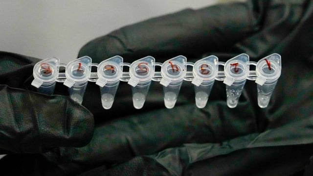 Bird flu samples are tested in a New York lab in 2022. In 2024, the bird flu has been spreading between poultry, cattle and now humans. But health officials still say human-to-human infection is unlikely.