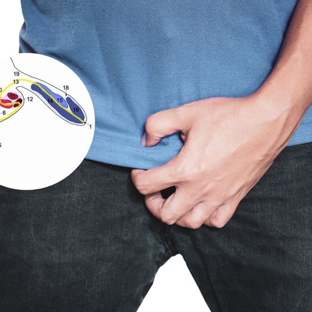 Stock image of a man holding his crotch (main) and a diagram from the paper revealing the structures of the two extra penises (inset). This is the second-ever reported case of triphallia, and was only found during the dissection of the man's body.