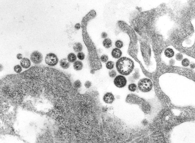 Transmission electron microscopic image of numerous Lassa virus particles grown in cell culture. The extracellular, spherical virions can vary in size and shape, and the black dots inside the particles are actually cellular ribosomes.