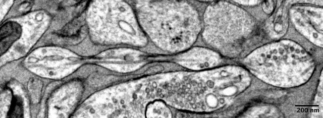 Micrograph image of the "pearling" structure of an axon. Credit: Quan Gan, Mitsuo Suga, Shigeki Watanabe