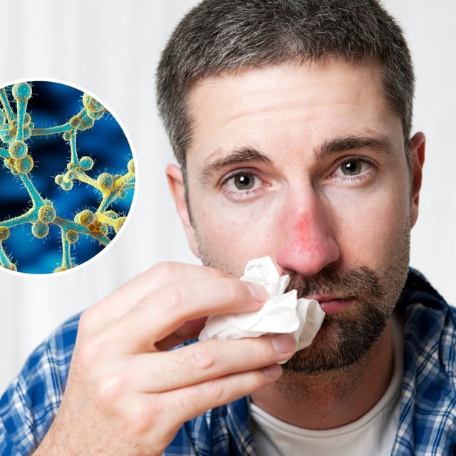 Stock images of a man with hay fever (main) and fungi (inset). People with hay fever have a greater variety of fungal species in their nose than those without.