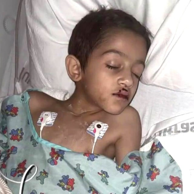 Falling drone seriously injures boy during Florida holiday show.