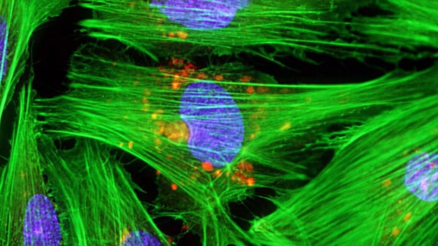 An image of fluorescently stained cells against a black backdrop. The cell's nucleus is blue, while its muscle fibers are green.