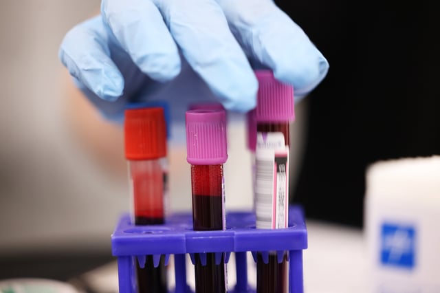 NEW YORK, NEW YORK - AUGUST 13: Blood for testing is placed on a holder at a New York Blood Center's Brooklyn Donor Center on August 13, 2024 in Downtown Brooklyn in New York City. The American Red Cross reported that there is a shortage of blood in its national blood supply due to the cancelations of more than 100 blood drives nationwide amid high temperatures during the summer. (Photo by Michael M. Santiago/Getty Images)