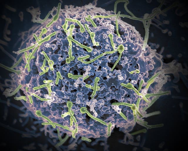 Ebola virus isolated in November 2014 from patient blood samples obtained in Mali. The virus was isolated on Vero cells. Credit: NIAID
