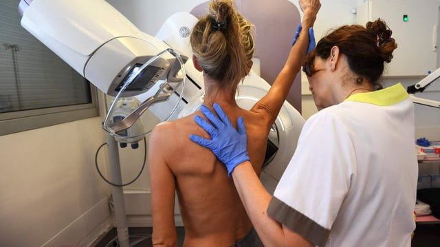 Using AI to screen for breast cancer could free up hundreds of radiologists
